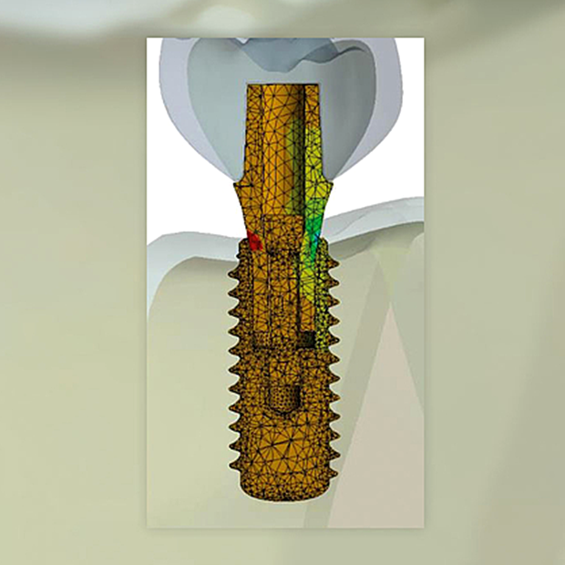 Illustration eines sicherheitsintegrierten und infektionsreaktiven Implantats